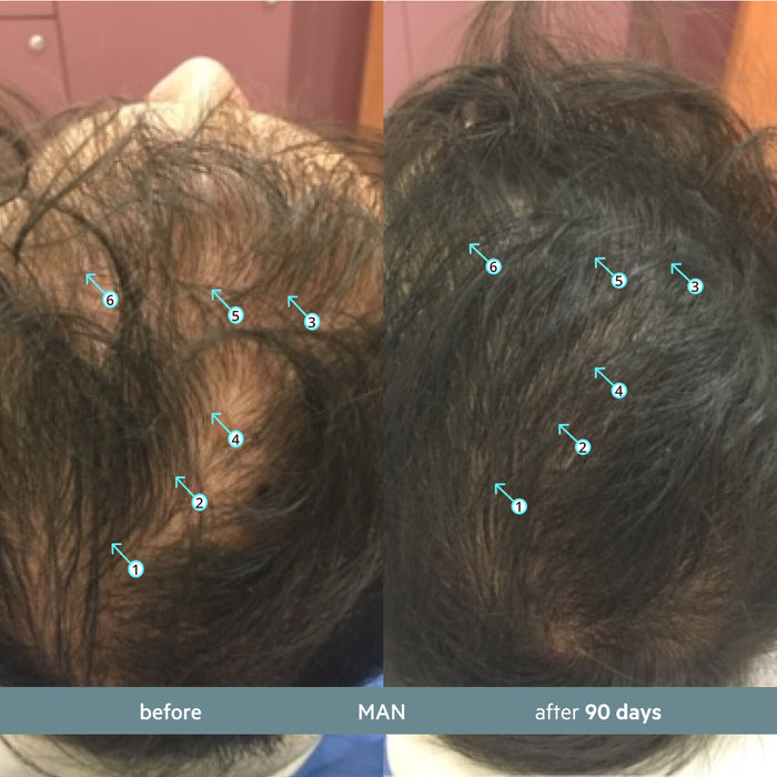 Revita.SOD 2 Pack - 2 Month Supply | Advanced Antioxidant Protection for Hair Longevity
