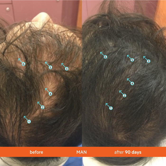Revita | TABLETS FOR HAIR GROWTH SUPPORT