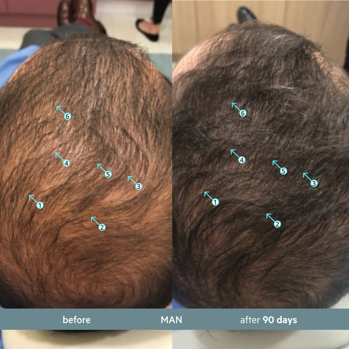 Revita.SOD 2 Pack - 2 Month Supply | Advanced Antioxidant Protection for Hair Longevity