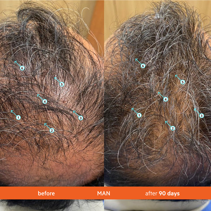 Spectral Women's (CSF) 3 Month Supply |+ Free Revita Shampoo for Life!