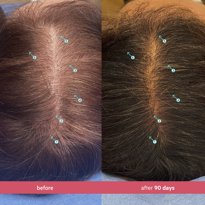 SPECTRAL WOMEN'S (CSF) 3 MONTH SUPPLY|+ FREE STIMUROLLER FOR LIFE!