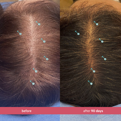SPECTRAL WOMEN'S (CSF) 3 MONTH SUPPLY|+ FREE STIMUROLLER FOR LIFE!